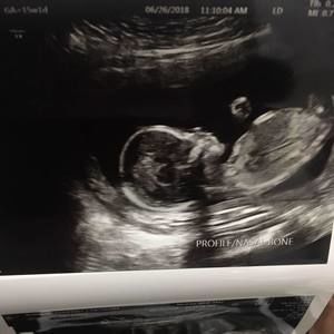 Meet your Posher, Lorenzo